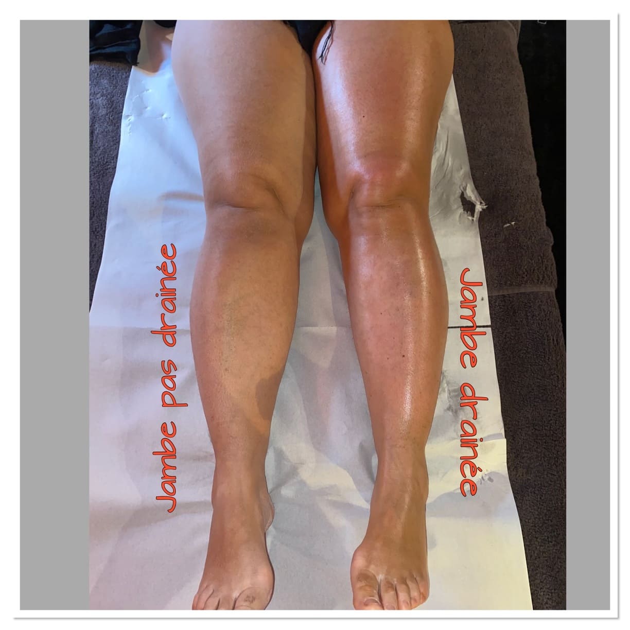 Drainage lymphatique jambes Luxembourg - Renata França